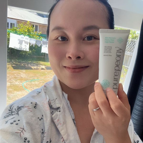 customer gave five star review of nz eczema cream