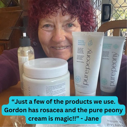 customer with several eczema and rosacea natural treatment products her husband describes as magic rosacea cream